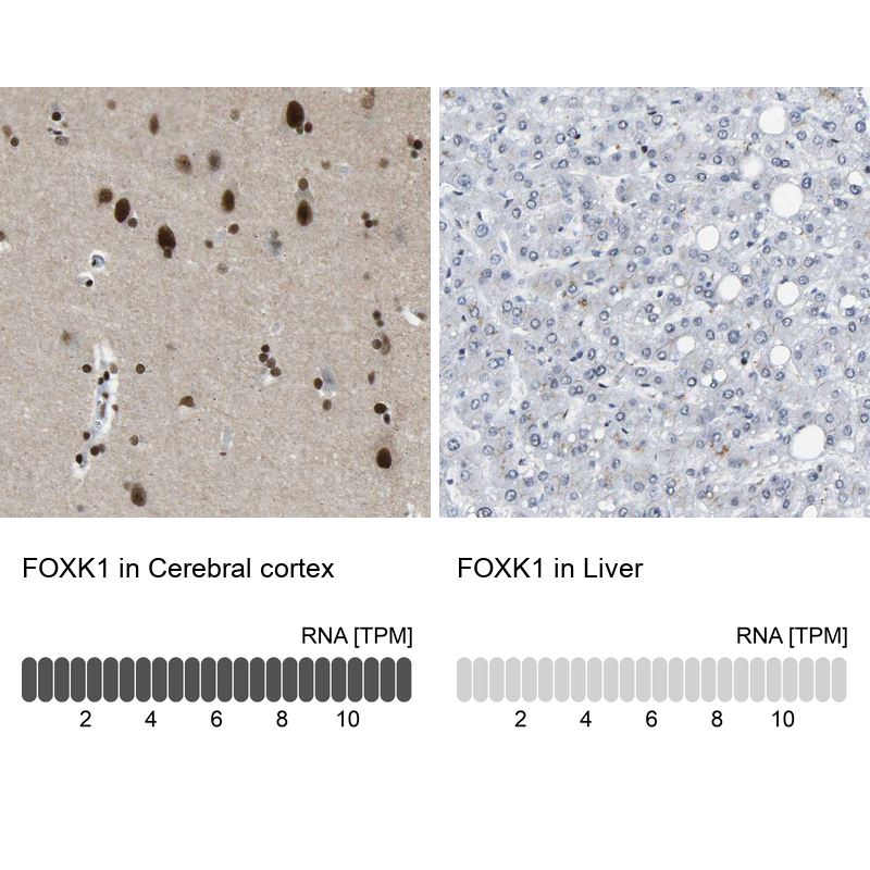 Anti-FOXK1 Antibody