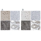 Immunohistochemical staining of human cerebral cortex, liver, lymphoid tissues and testis using Anti-FOXK1 antibody HPA017998 (A) shows similar protein distribution across tissues to independent antibody HPA018864 (B).