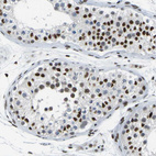 Immunohistochemical staining of human testis shows moderate to strong nuclear positivity in cells in seminiferous ducts.