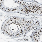 Immunohistochemical staining of human testis shows moderate to strong nuclear positivity in cells in seminiferous ducts.