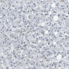 Immunohistochemical staining of human liver shows no positivity in hepatocytes as expected.