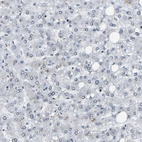 Immunohistochemical staining of human liver shows no positivity in hepatocytes as expected.