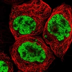 Immunofluorescent staining of human cell line A-431 shows localization to nucleoplasm.