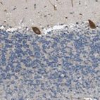 Immunohistochemical staining of human cerebellum shows strong cytoplasmic positivity in Purkinje cells.