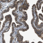 Immunohistochemical staining of human Fallopian tube shows moderate cytoplasmic and membranous positivity in glandular cells.