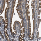 Immunohistochemical staining of human gastrointestinal shows moderate cytoplasmic and membranous positivity in glandular cells.