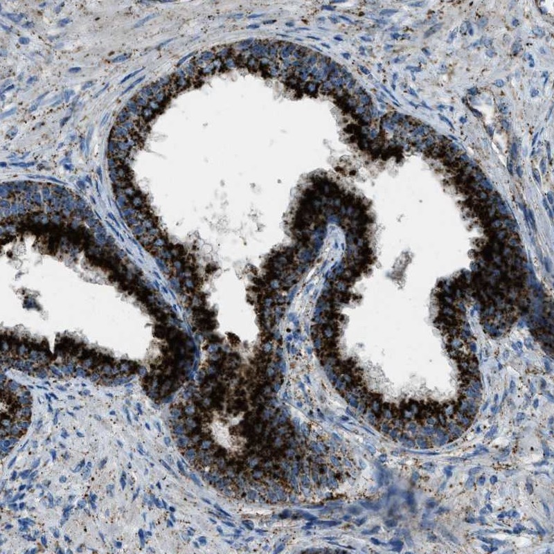 Anti-SCARB2 Antibody