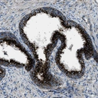 Anti-SCARB2 Antibody