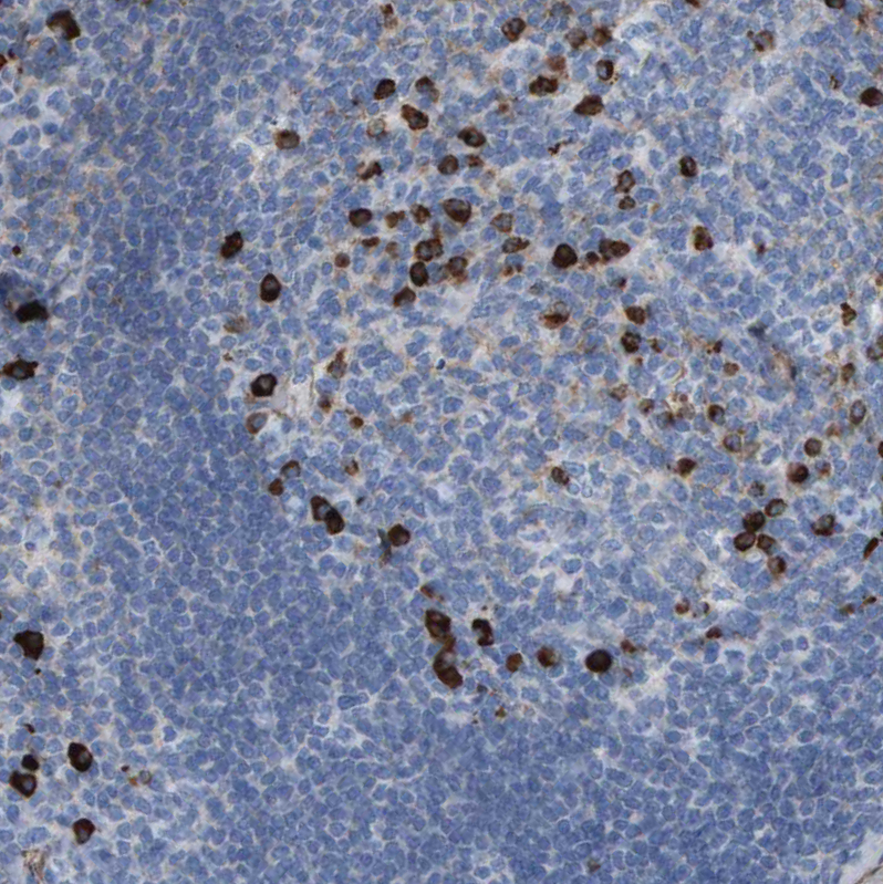 Anti-IFNAR1 Antibody
