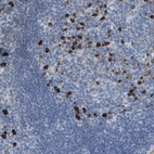 Anti-IFNAR1 Antibody
