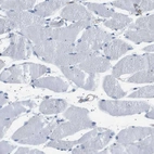 Immunohistochemical staining of human skeletal muscle shows no positivity in myocytes as expected.