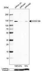 Anti-CCDC186 Antibody