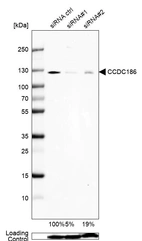 Western blot analysis in Rh30 cells transfected with control siRNA, target specific siRNA probe #1 and #2, using Anti-CCDC186 antibody. Remaining relative intensity is presented. Loading control: Anti-GAPDH.