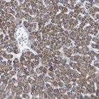 Anti-GPR149 Antibody