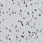 Anti-TTC13 Antibody