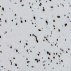 Anti-TTC13 Antibody