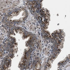 Immunohistochemical staining of human prostate shows strong granular cytoplasmic positivity in glandular cells.