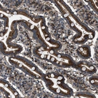 Immunohistochemical staining of human duodenum shows strong granular cytoplasmic positivity in glandular cells.