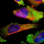 Immunofluorescent staining of human cell line U-251 MG shows localization to cytosol.