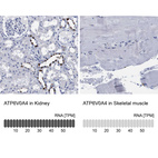 Anti-ATP6V0A4 Antibody