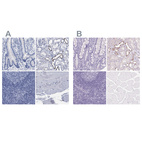 Immunohistochemistry analysis in human kidney and skeletal muscle tissues using HPA018029 antibody. Corresponding ATP6V0A4 RNA-seq data are presented for the same tissues.