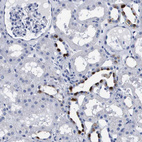 Immunohistochemical staining of human cerebral cortex, colon, kidney and liver using Anti-ATP6V0A4 antibody HPA018029 (A) shows similar protein distribution across tissues to independent antibody HPA064555 (B).