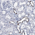 Immunohistochemical staining of human cerebral cortex, colon, kidney and liver using Anti-ATP6V0A4 antibody HPA018029 (A) shows similar protein distribution across tissues to independent antibody HPA064555 (B).