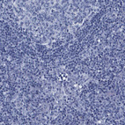 Immunohistochemical staining of human kidney shows high expression.