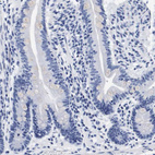 Immunohistochemical staining of human kidney shows strong membranous positivity in cells in tubules.