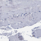 Immunohistochemical staining of human lymph node shows low expression as expected.
