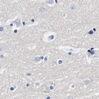 Immunohistochemical staining of human cerebral cortex using Anti-ATP6V0A4 antibody HPA018029.