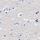 Immunohistochemical staining of human cerebral cortex using Anti-ATP6V0A4 antibody HPA018029.
