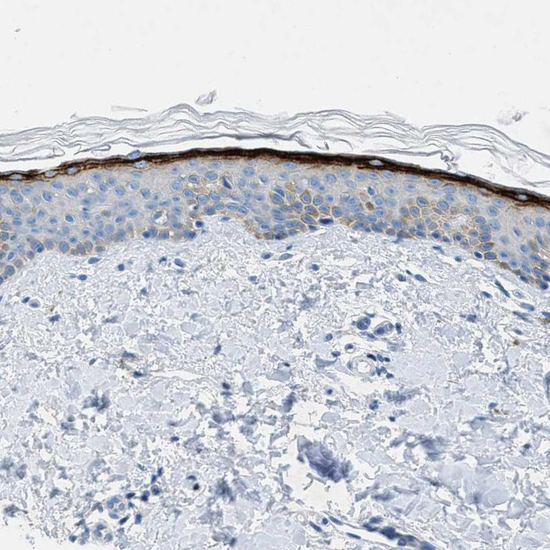 Anti-MFSD13A Antibody