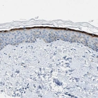 Anti-MFSD13A Antibody