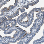 Immunohistochemical staining of human Fallopian tube shows strong positivity in cilia in glandular cells.