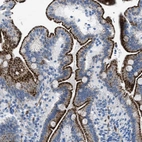 Immunohistochemical staining of human duodenum shows strong granular cytoplasmic positivity in glandular cells.
