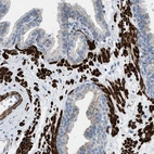Immunohistochemical staining of human prostate shows strong cytoplasmic positivity in smooth muscle cells.