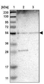 Anti-MFSD13A Antibody