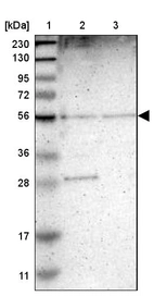 Lane 1: Marker [kDa] 230, 130, 95, 72, 56, 36, 28, 17, 11_br/_Lane 2: Human cell line RT-4_br/_Lane 3: Human cell line U-251MG sp