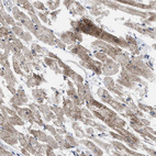 Immunohistochemical staining of human heart muscle shows moderate granular cytoplasmic positivity in cardiomyocytes.