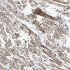 Immunohistochemical staining of human heart muscle shows moderate granular cytoplasmic positivity in cardiomyocytes.
