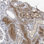 Immunohistochemical staining of human kidney shows moderate granular cytoplasmic positivity in cells in tubules.
