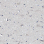 Immunohistochemical staining of human cerebral cortex shows very weak cytoplasmic positivity in neurons.