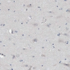 Immunohistochemical staining of human cerebral cortex shows very weak cytoplasmic positivity in neurons.