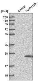 Anti-TMEM159 Antibody