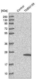 Western blot analysis in control (vector only transfected HEK293T lysate) and TMEM159 over-expression lysate (Co-expressed with a C-terminal myc-DDK tag (~3.1 kDa) in mammalian HEK293T cells, LY412473).