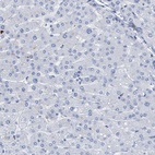 Immunohistochemical staining of human liver shows low expression as expected.