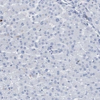 Immunohistochemical staining of human liver shows low expression as expected.