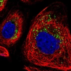Immunofluorescent staining of human cell line A-431 shows localization to the Golgi apparatus & vesicles.