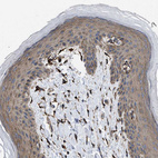 Immunohistochemical staining of human skin shows moderate cytoplasmic positivity in squamous epithelial cells.